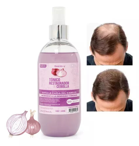 Tonico Capilar De Cebolla Anticaida