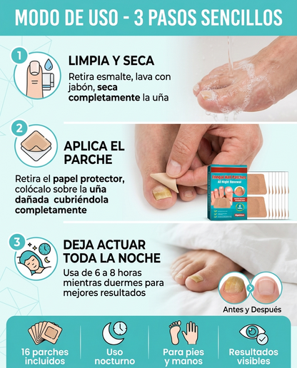 "Parche Uñas Antihongos x16 – ¡2x1 para un Cuidado Completo de Tus Uñas!"