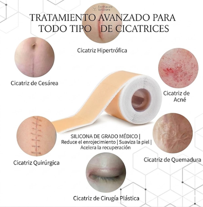 Tratamiento Efectivo y Cómodo para Todo Tipo de Cicatrices: Rollo de Cinta de Silicona de Grado Médico