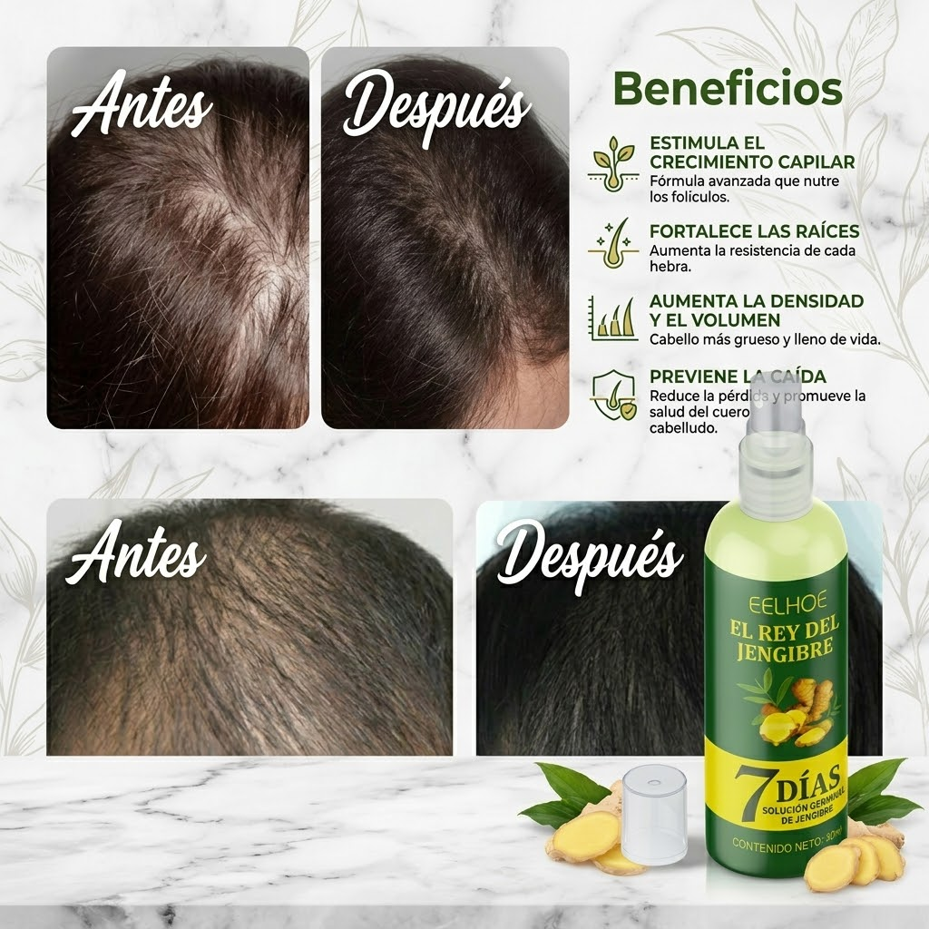 Vedora King of Ginger Hair Oil – Aceite de Jengibre para Crecimiento Natural del Cabello | 30 ml